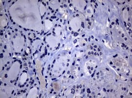 POLI Antibody (aa458-740, clone OTI1C8)