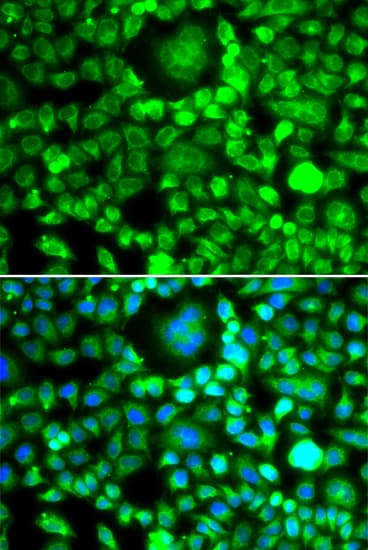 BLID Antibody