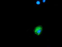 Monoclonal Mouse anti-Human SQSTM1 Antibody (clone OTI4E2, IHC, IF, WB)