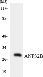 ANP32B Antibody (aa37-86)