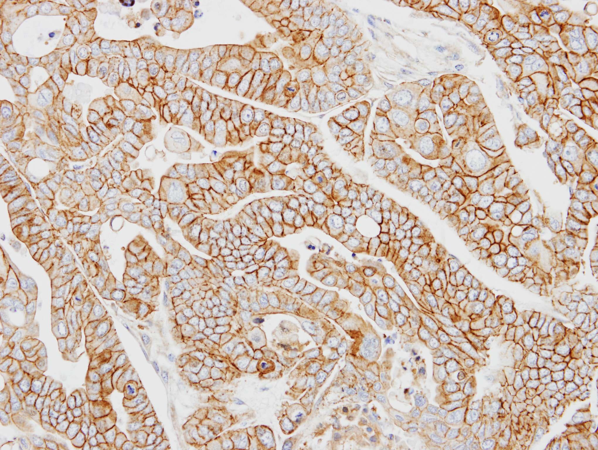 AP50 / AP2M1 Antibody (aa1-150)