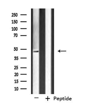 SIRPB1 / CD172b Antibody