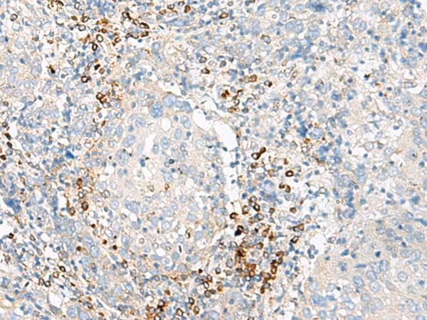 Polyclonal Rabbit anti-Human Hemoglobin Gamma (HBG1 + HBG2) Antibody (IHC, WB)