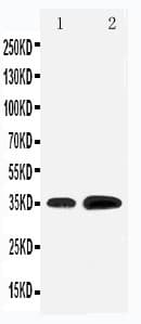 Polyclonal Rabbit anti-Human KLF3 Antibody (aa20-34, WB)