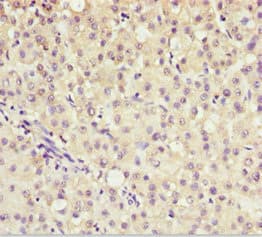 AKR7A2 / AFAR Antibody