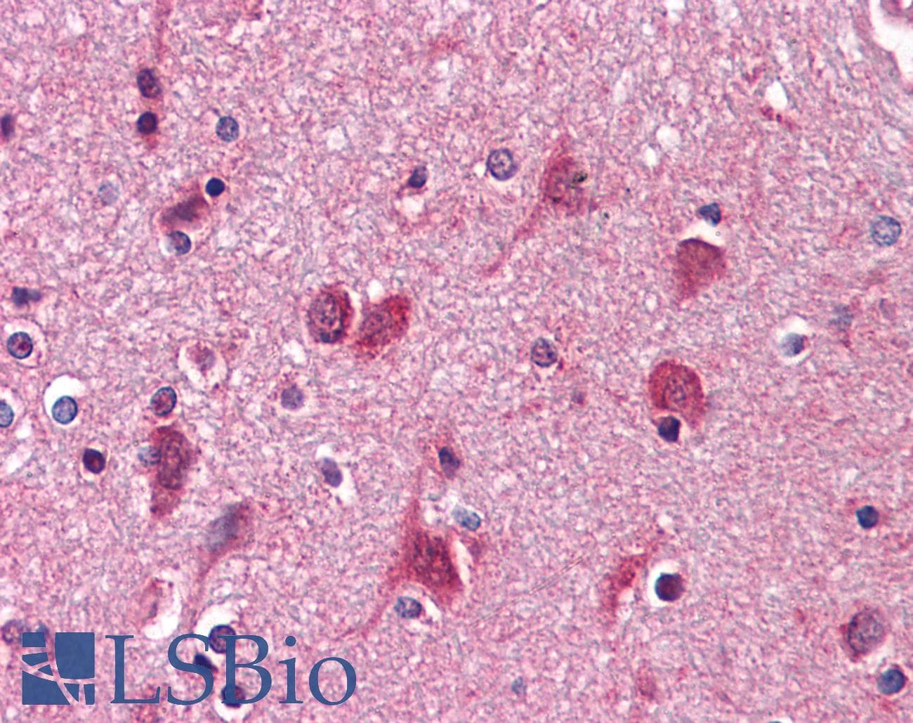 IHC-plus™ AGPS Antibody