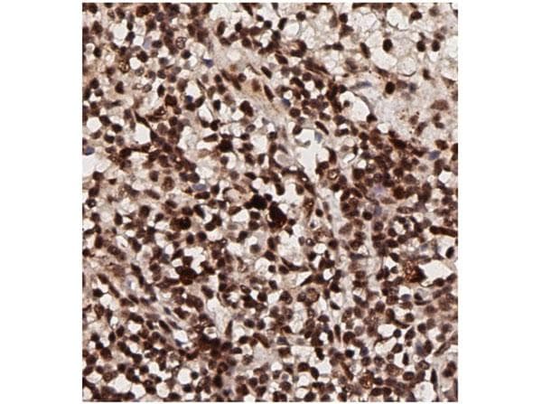 AKT1 Antibody (phospho-Thr308)
