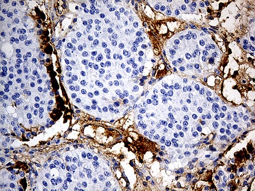 PLG / Plasmin / Plasminogen Antibody (aa301-586, clone OTI4F5)