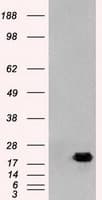 AK1 / Adenylate Kinase 1 Antibody (clone OTI19D1)