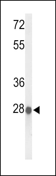 ABHD11 Antibody (aa176-205)