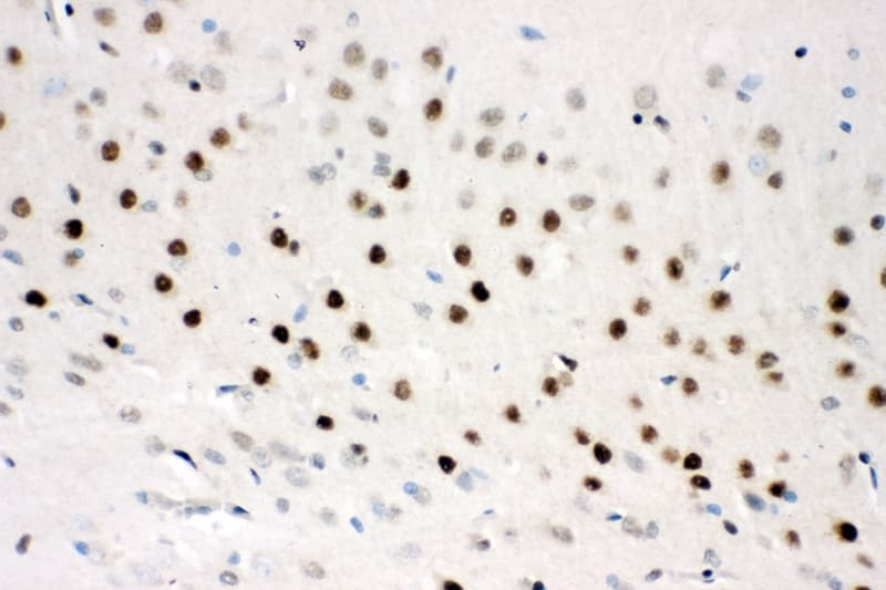 Polyclonal Rabbit anti-Human CTBP2 Antibody (aa429-445, IHC, WB)