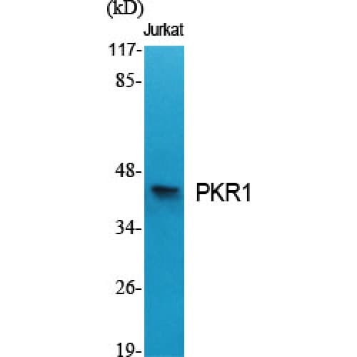 PROKR1 Antibody (30-110 aa, N-terminal)