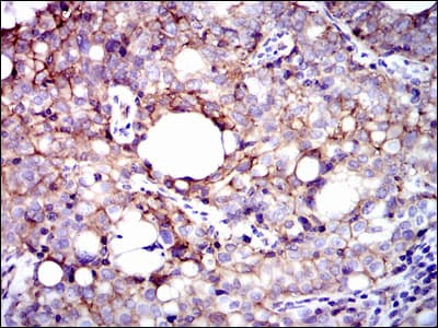 ITGB1 / Integrin Beta 1 / CD29 Antibody (clone 3B6)