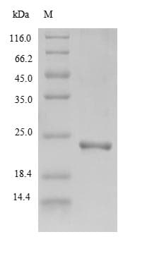 Schistosoma mansoni Scytovirin (SVN) Protein (Recombinant 6His-B2M, N-terminus)