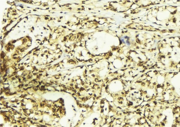 PRKCA / PKC-Alpha Antibody (phospho-Thr497)