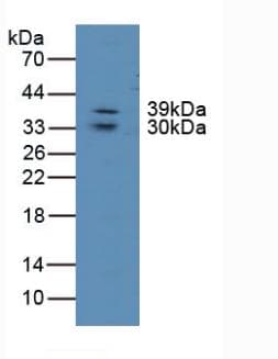LIPG / Endothelial Lipase Antibody (aa175-412)