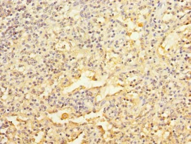 RAPGEF5 / GFR Antibody
