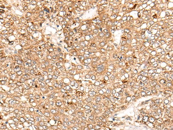 Polyclonal Rabbit anti-Human Complement C1s Antibody (IHC)