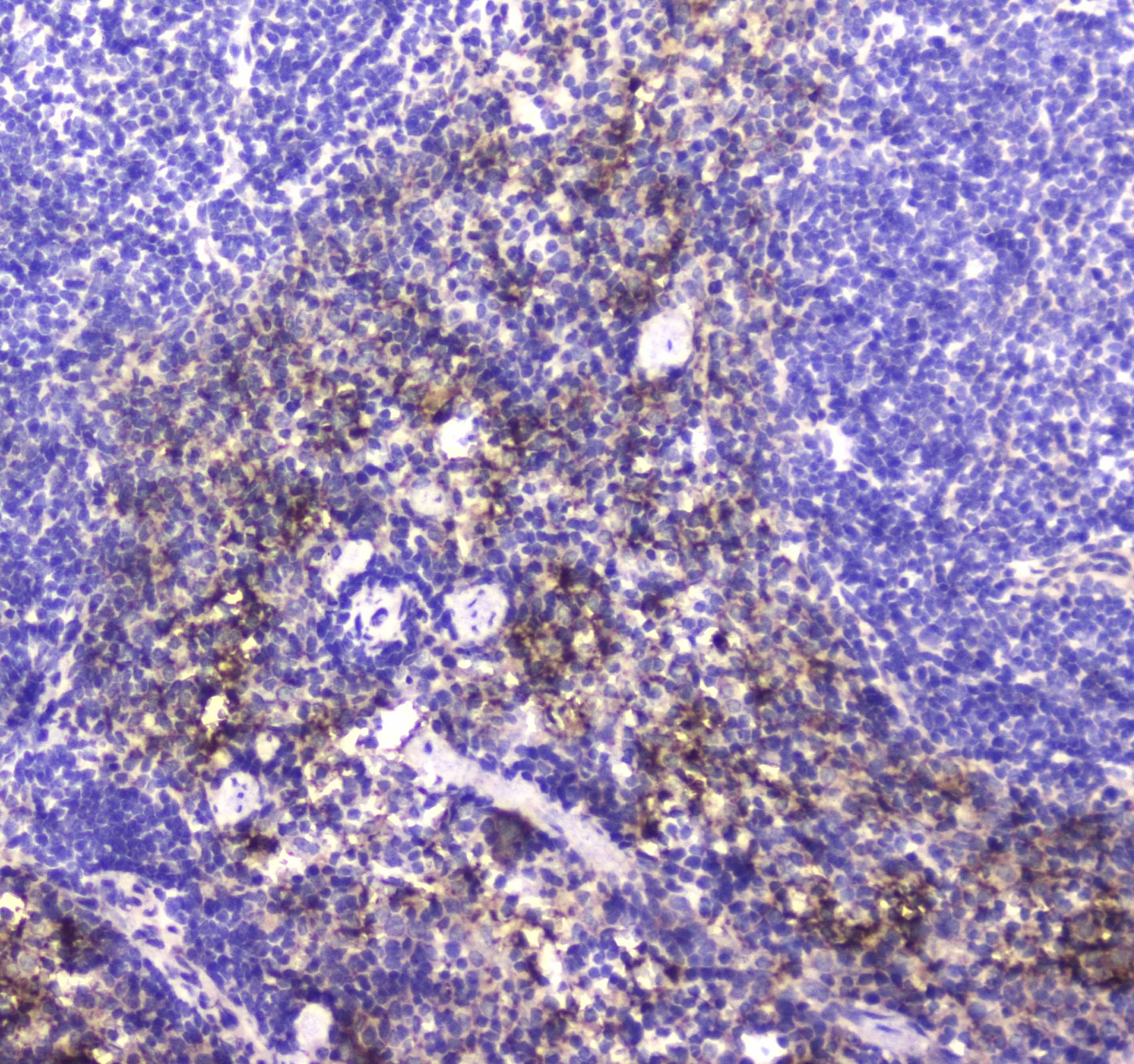 Polyclonal Rabbit anti-Human NCR1 / NKP46 Antibody (IHC, WB)