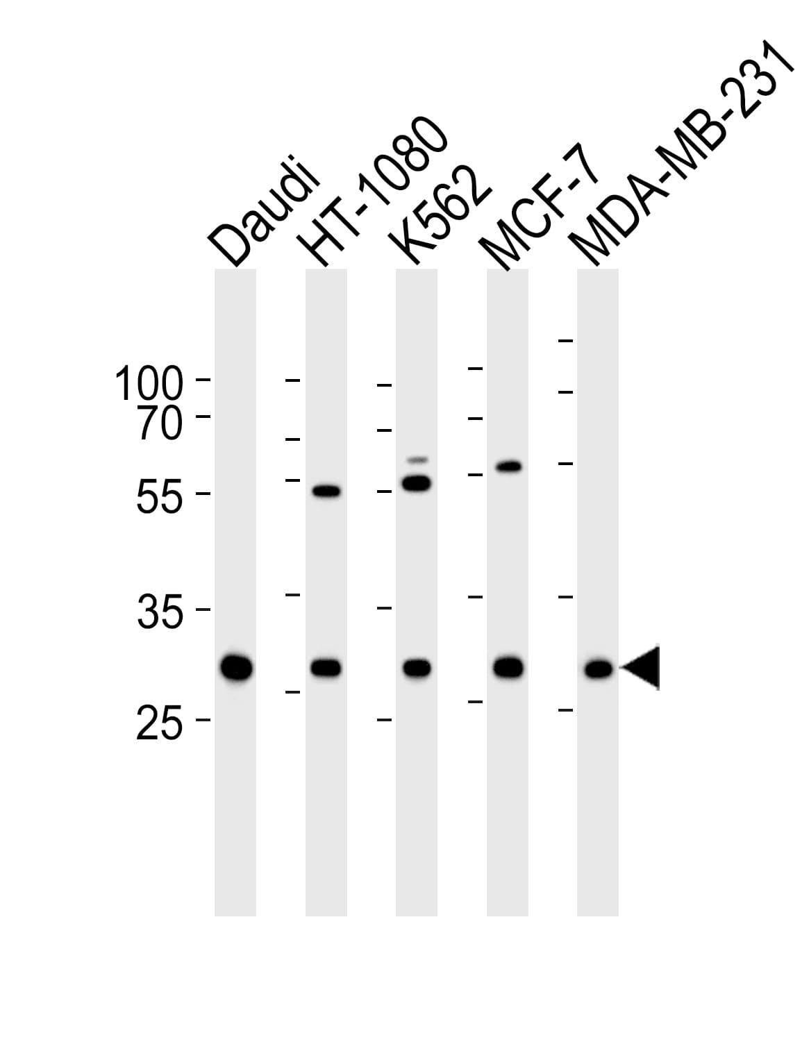 PNP / Nucleoside Phosphorylase Antibody (aa145-178)