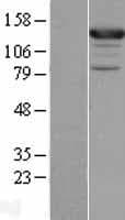 ASAP1 Protein (Over-Expression Lysate Myc-DDK (Flag))
