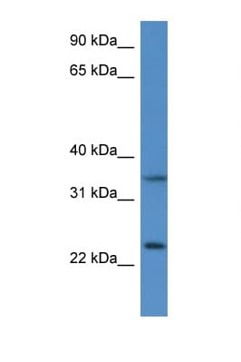 Polyclonal Rabbit anti-Mouse CYB5R1 Antibody (aa93-142, WB)