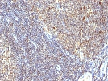 Proliferation Marker IPO-38 Antibody (clone SPM260)