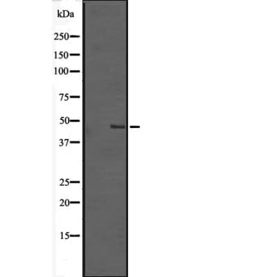 TMEM184B Antibody