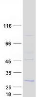 Human RD3 Protein (Recombinant Myc-DDK (Flag))