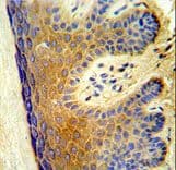 Polyclonal Rabbit anti-Human ALOX15B / 15-LOX-2 Antibody (aa597-627, IHC, WB)