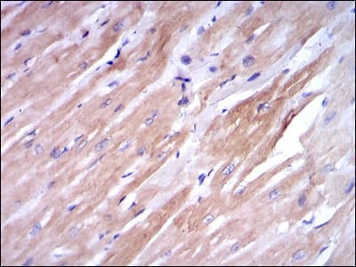 Monoclonal Mouse anti-Human TNNI2 Antibody (clone 2F12A11, IHC, WB)