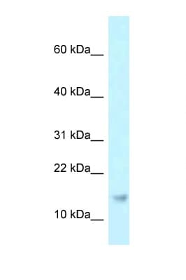 RPP21 Antibody (aa69-118)