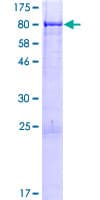Human JRK Protein (Recombinant GST)