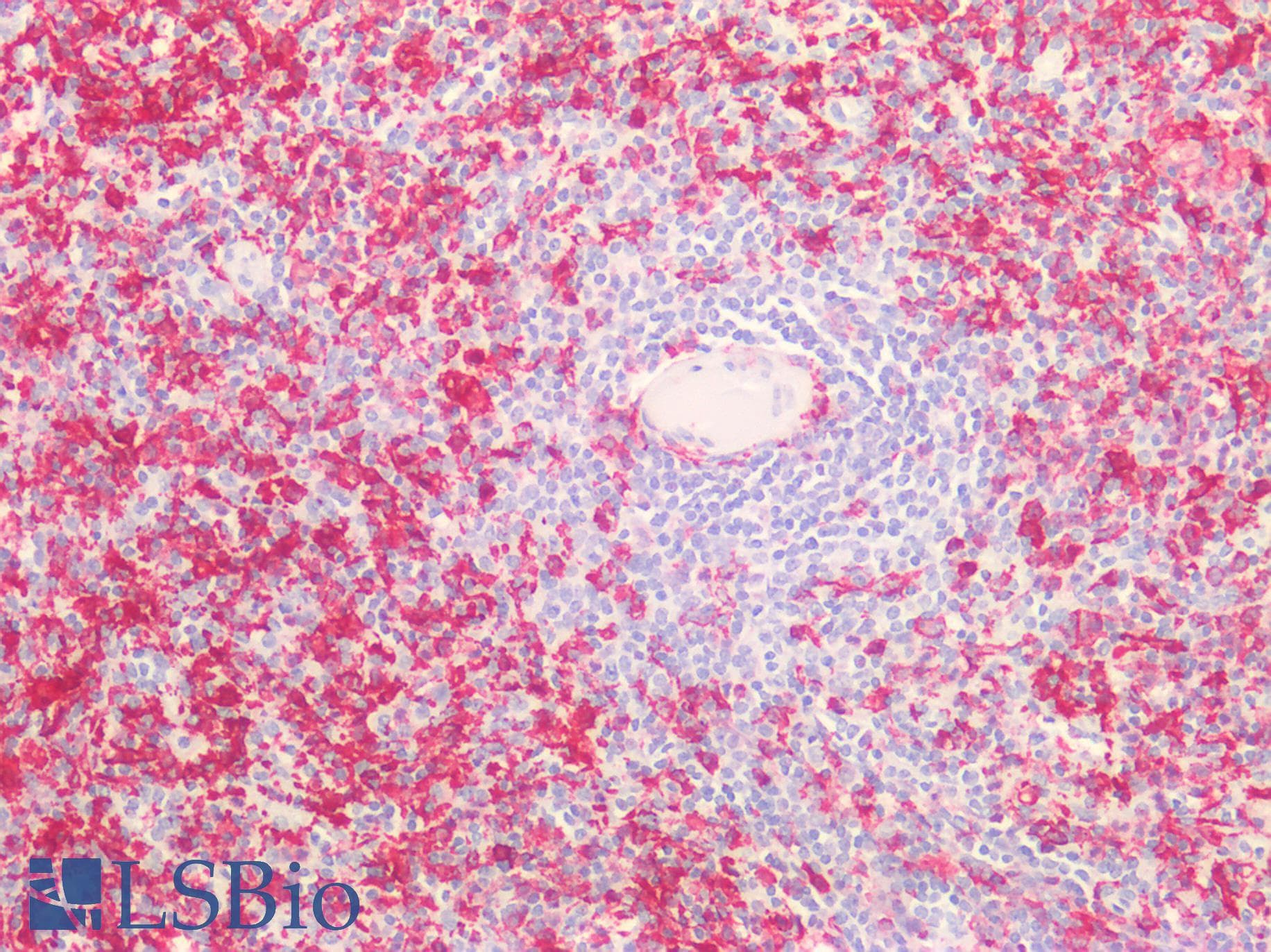 IHC-plus™ Polyclonal Rabbit anti-Human AIF1 / IBA1 Antibody (IHC, IF, WB)