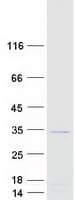 Human MORN3 Protein (Recombinant Myc-DDK (Flag))