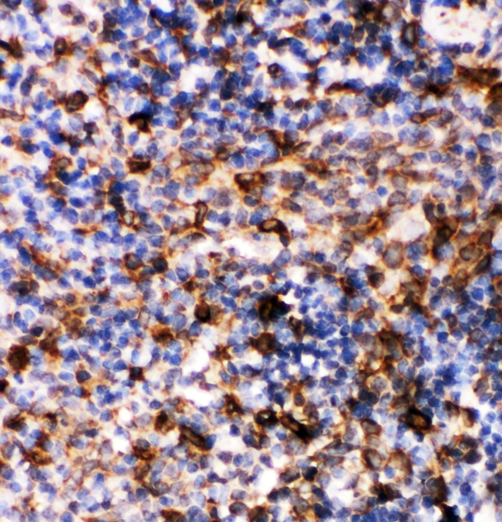 CASP6 / Caspase 6 Antibody (aa7-27)
