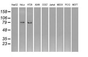 Monoclonal Mouse anti-Human GBE1 Antibody (clone OTI1D11, IHC, IF, WB)