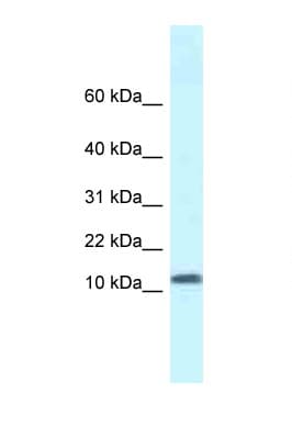 SSBP1 / mtSSB Antibody (aa16-65)