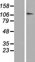 Human DPYD / DPD Protein (Over-Expression Lysate Myc-DDK (Flag))