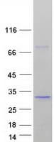 Human SDF2 Protein (Recombinant Myc-DDK (Flag))