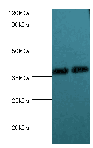 DDX / AKR1C3 Antibody (aa1-323)