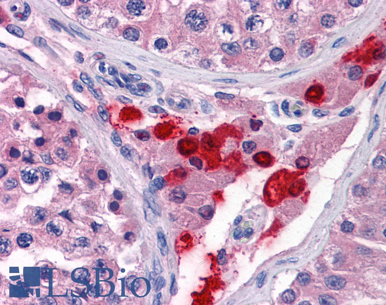 IHC-plus™ TWIST2 Antibody (clone 3C8)