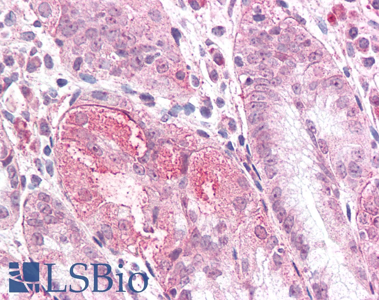 IHC-plus™ TMEM33 Antibody (Internal)