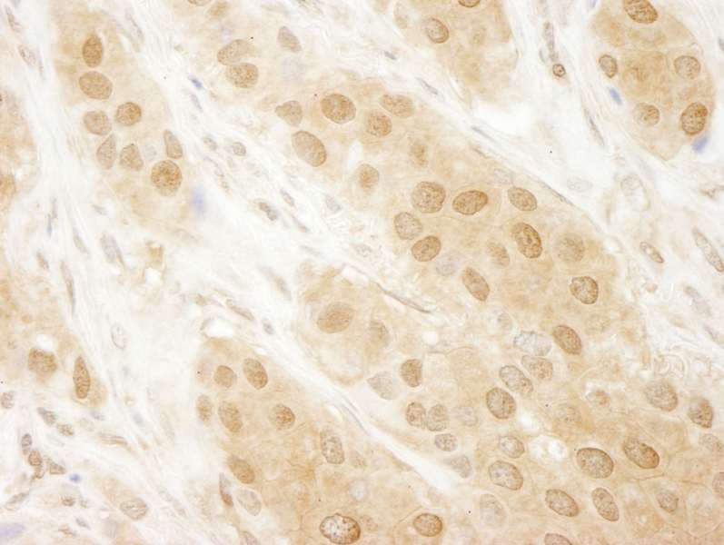 PARK7 / DJ-1 Antibody (aa140-C-term)