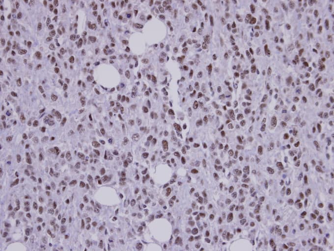 Polyclonal Rabbit anti-Human SAP130 Antibody (aa1154-1217, IHC, WB)