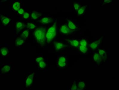 Polyclonal Rabbit anti-Human HMX2 Antibody (IHC, IF)