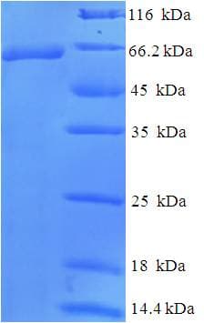 Human WT1 / Wilms Tumor 1 Protein (Recombinant 6His-SUMO, N-terminus)