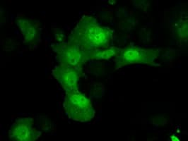AKR1A1 Antibody (clone OTI6E3)