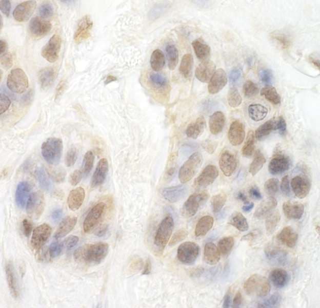 Polyclonal Rabbit anti-Human CDK8 Antibody (aa420-470, IHC, WB)