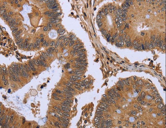Polyclonal Rabbit anti-Human FHL2 Antibody (IHC, WB)